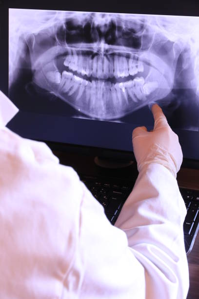 Best Emergency Treatment for Oral Infections in Berwick, PA